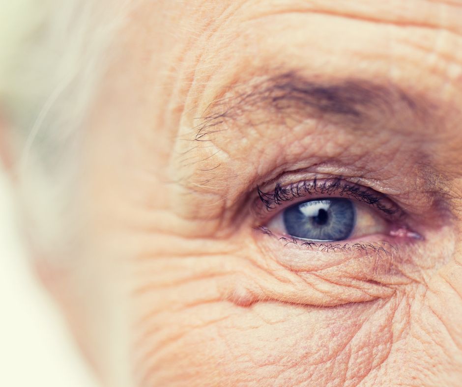 macular degeneration